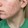 Review photo